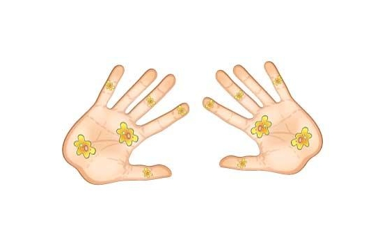 Obrázek aktuality Epidemický výskyt infekční žloutenky