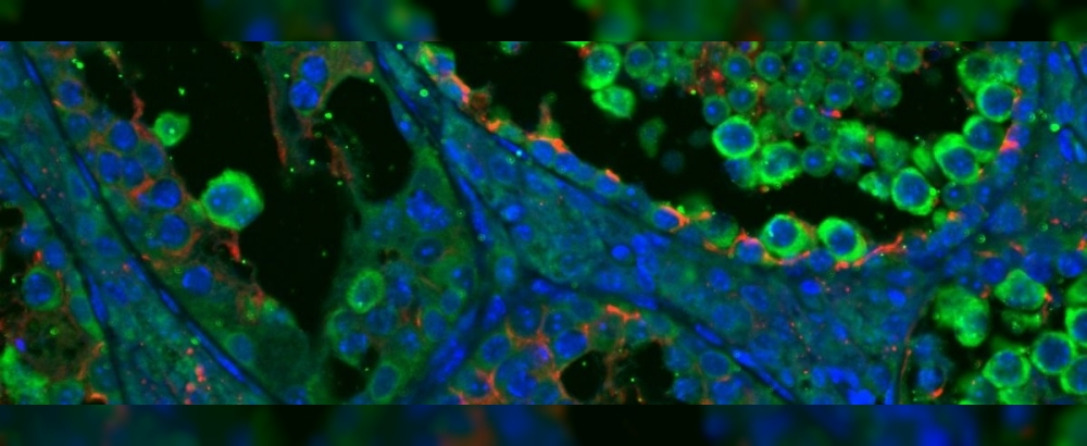 Obrázek článku Další číslo časopisu A / Věda a výzkum je tady